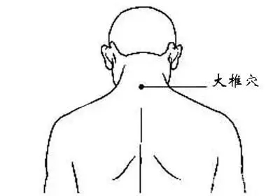 注意：大椎穴凸起，是个危险的信号