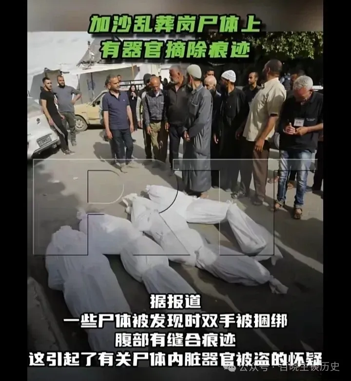 巴以冲突背后的恐怖秘密:以色列“皮肤银行”以及“器官买卖”