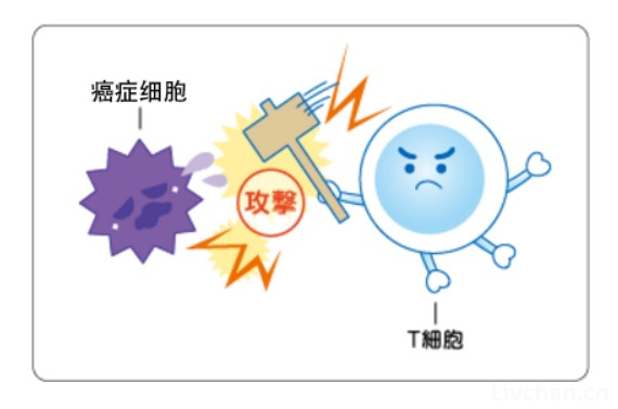 癌症知识大全 