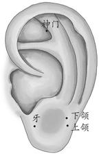 牙痛