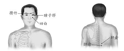 青光眼