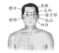 假性近视 假性近视
