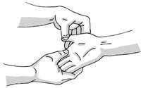 过敏性鼻炎