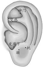 头面部疾病-偏头痛