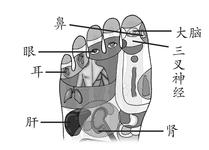 面瘫