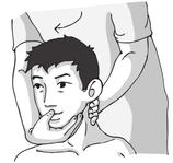 颈项部疾病-颈椎病