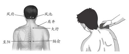 落枕