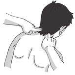 落枕