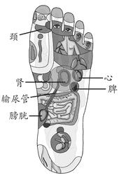 落枕