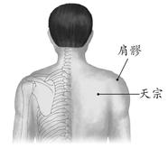 四肢部疾病-肩周炎