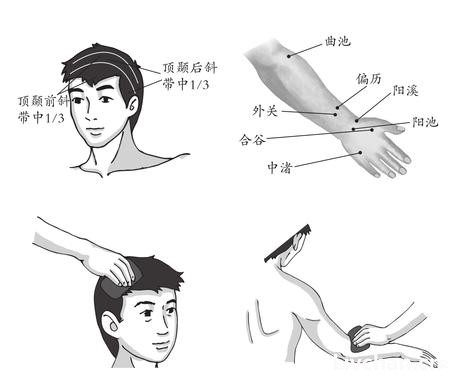 鼠标手
