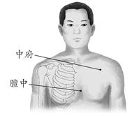 慢性支气管炎