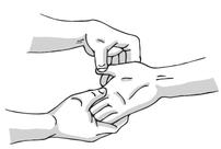 慢性支气管炎