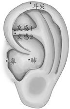 慢性支气管炎