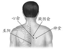 冠心病