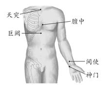 冠心病