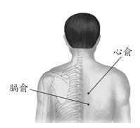 冠心病