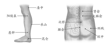 腰痛
