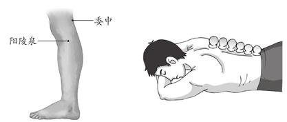 腰痛