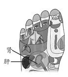 腰痛