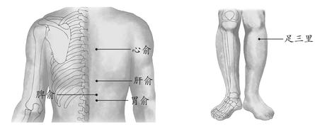 胃及十二指肠溃疡