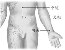 慢性阑尾炎
