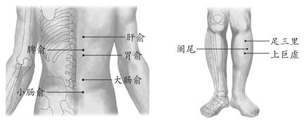 慢性阑尾炎