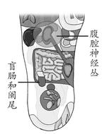 慢性阑尾炎