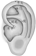 慢性阑尾炎