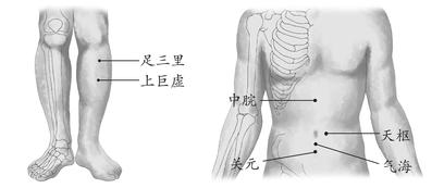 慢性腹泻