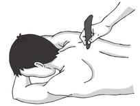 慢性胆囊炎
