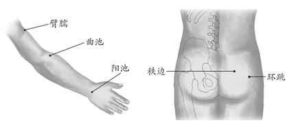 全身性疾病-中风后遗症