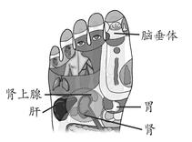 全身性疾病-中风后遗症