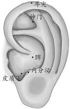 全身性疾病-中风后遗症