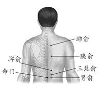 糖尿病