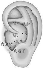 糖尿病
