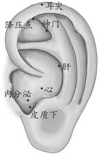高脂血症