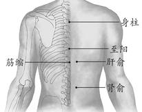 关节炎