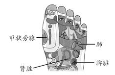 关节炎