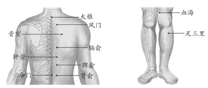 女性、儿童疾病-贫血