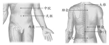 小儿腹泻
