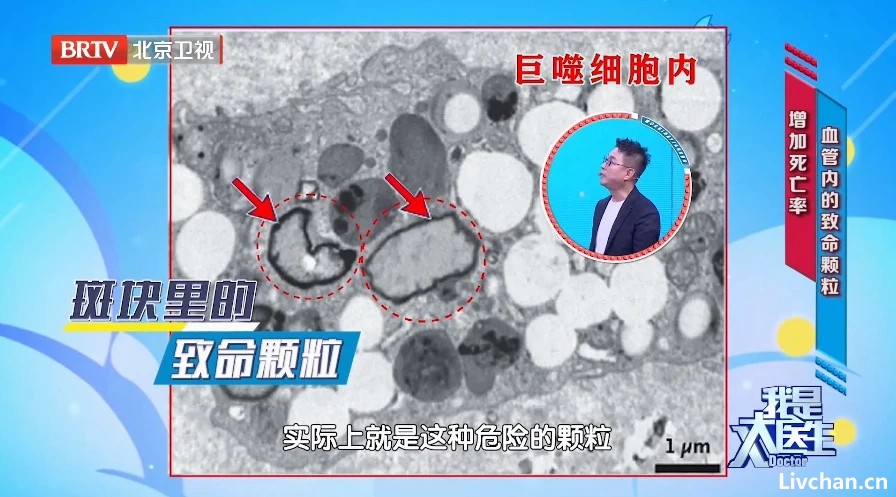 微塑料正在侵入大脑！研究发现：这些常见食物或能“驱逐”它