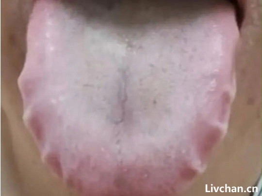 脸上有这8种症状，说明你的脾胃正在求救！